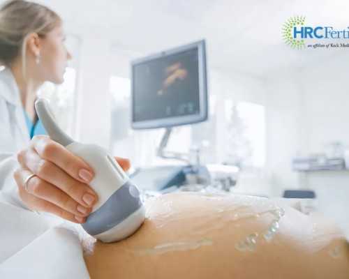 广州代孕一个小孩多少钱|威海正规医院供卵三代试管的具体流程是怎么样的？