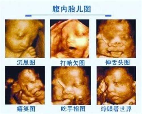 广州添禧助孕中心,生了小孩后腰痛是怎么回事 产后腰痛什么时候要看医生