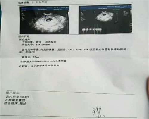 广州添禧助孕中心,生了小孩后腰痛是怎么回事 产后腰痛什么时候要看医生
