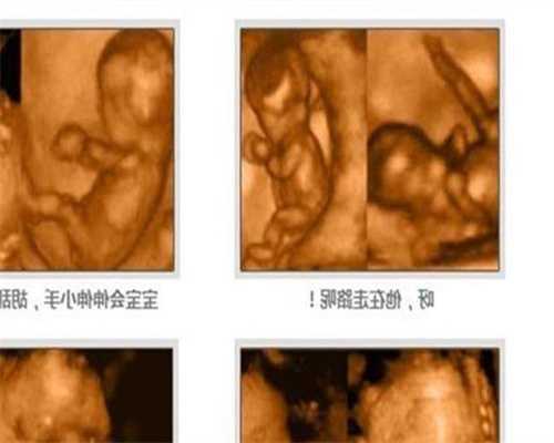广州代孕中介网站,怀孕8个月胎动情况