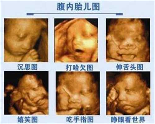 广州代孕产子价格生子,尿道炎有什么症状