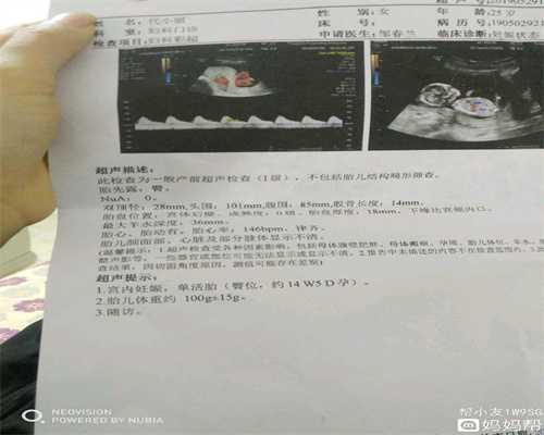 广州供卵交流群_广州供卵有孕母的基因吗_人流或无痛人流，可以快速恢复