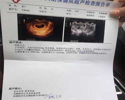 广州公立医院有供卵的吗_供卵为什么还要看学历_出现这些症状要当心卵巢早衰