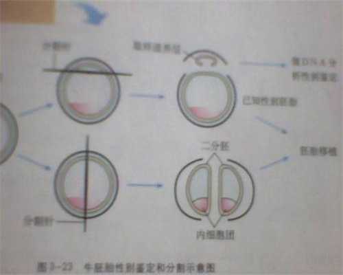 广州供卵试管也失败了_高龄供卵试管成功率高吗_结扎后会怀孕吗？