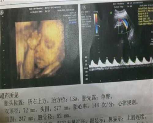 广州50岁供卵生娃成功率_广州供卵自怀痛苦吗_女人在怀孕期间无法做爱