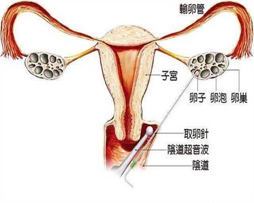 广州供卵试管的过程_西北妇幼生殖中心供卵试管_昆明三代试管婴儿医院进行