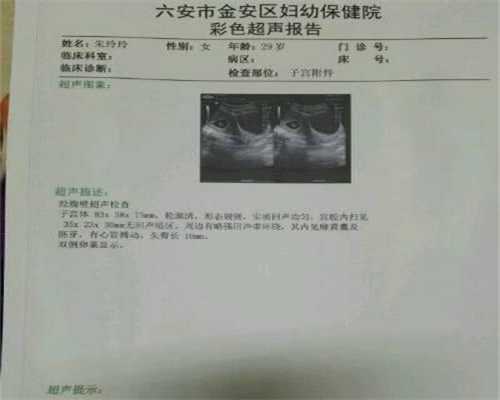 广州哪个医院排队供卵不用等_广州家恩德运医院供卵快吗_b超单子上有男女暗示