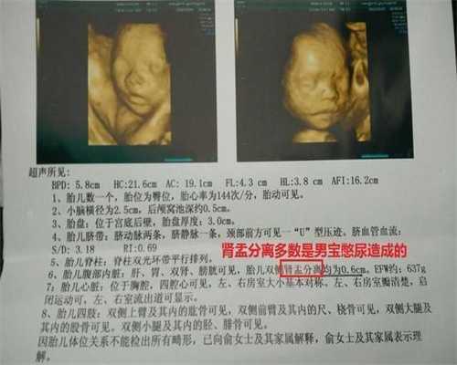 广州对供卵生的孩子的情感_唐都医院有没有供卵_腹腔镜-输卵管积水会对试管婴